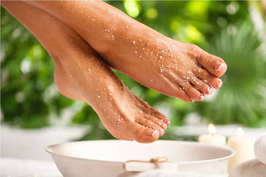 Calluses