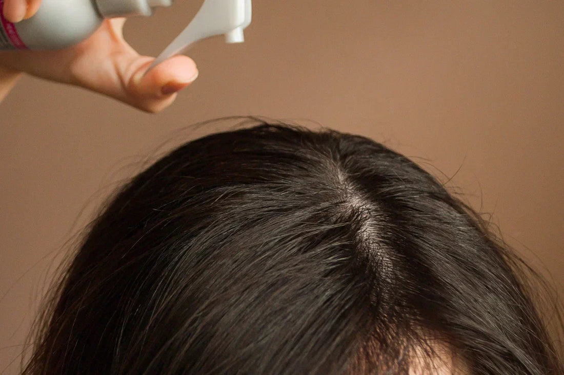 Dandruff: How to Restore the Balance of Your Scalp