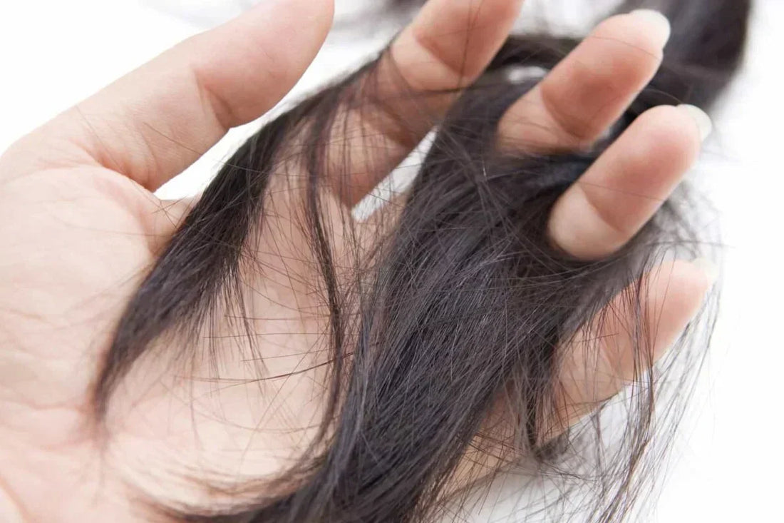 Understanding & Treating Hair Loss
